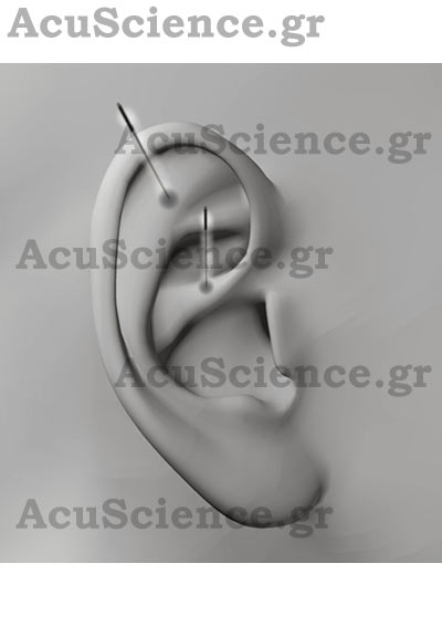 Acuscience.gr Βελονισμός στο Αυτί